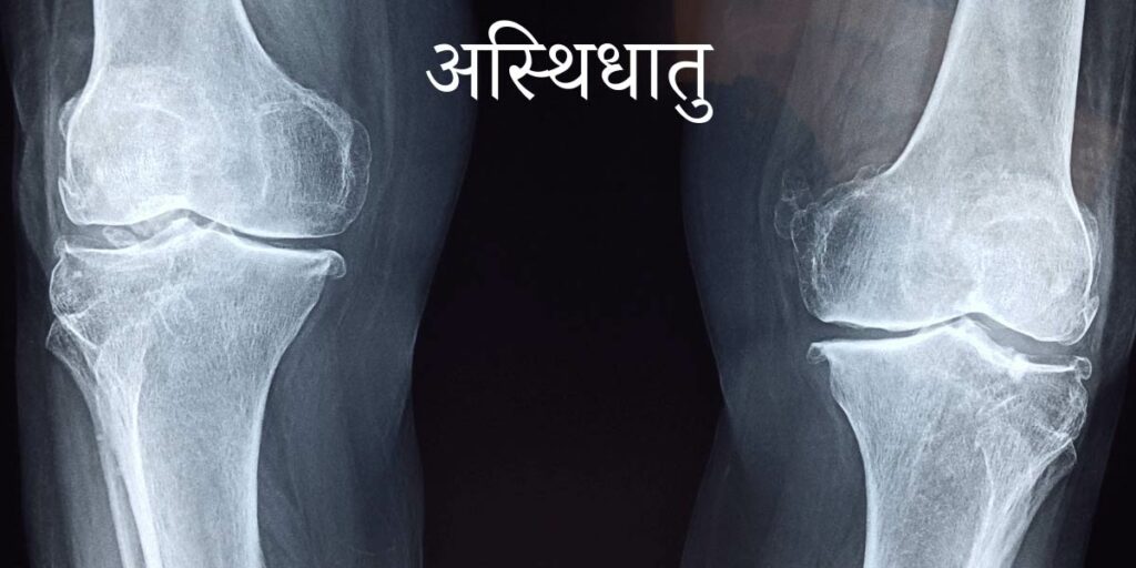 Asthi Dhatu - photo d'une radiographie osseusse